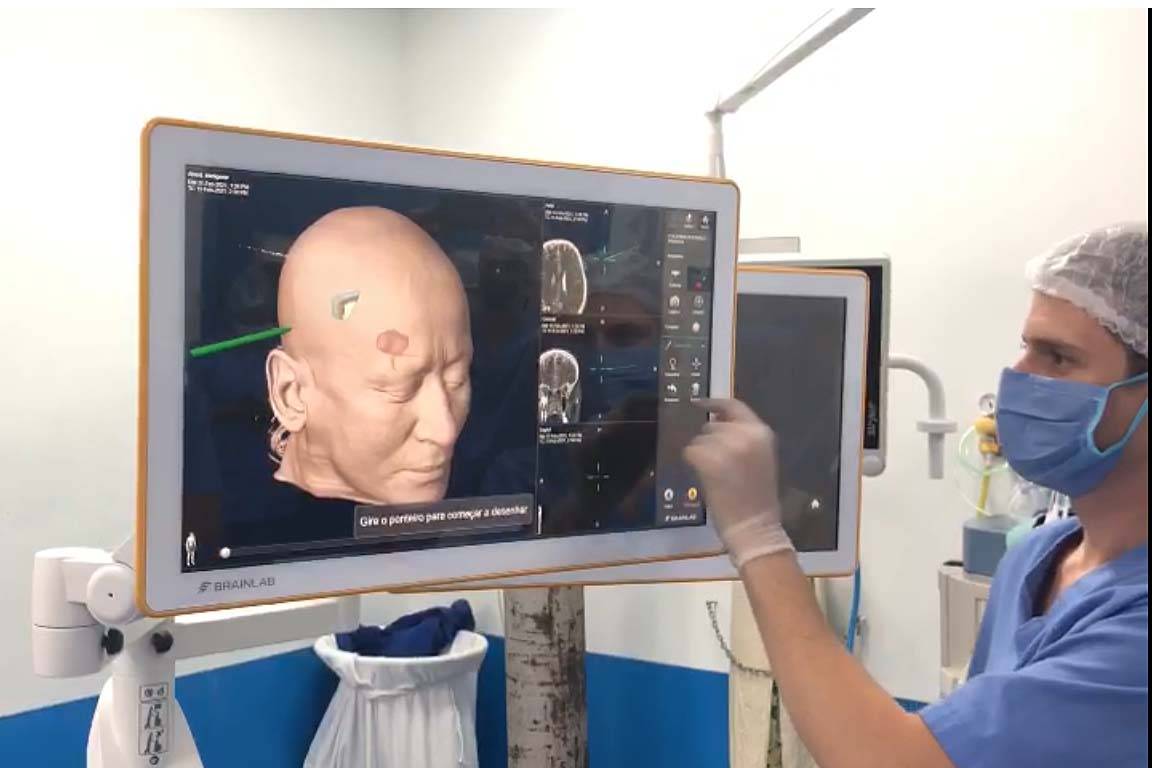 Hospital do Trabalhador realiza neurocirurgia com equipamento inédito no País