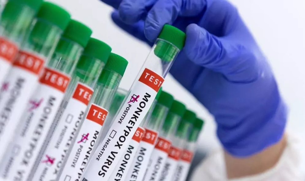 Secretaria da Saúde confirma mais quatro casos de varíola dos macacos